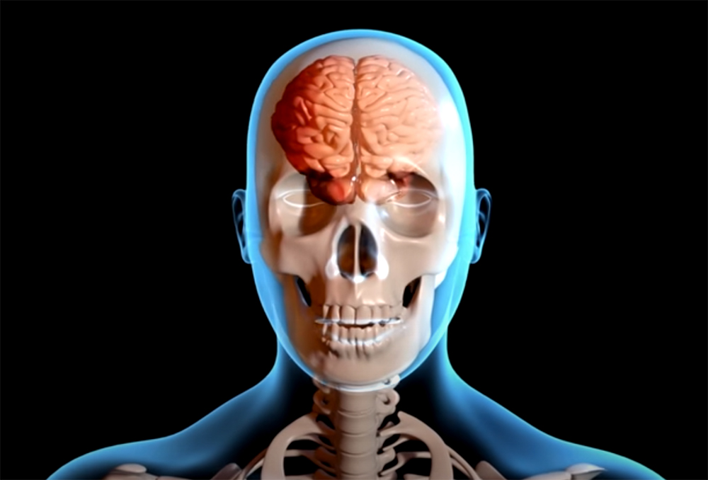 Head injuries and concussions