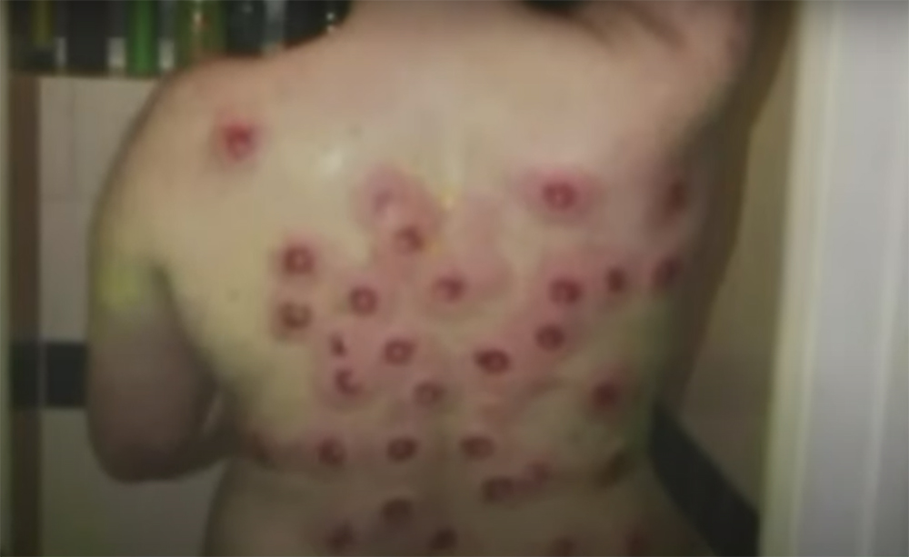 Can Paintball Guns or Paintballs Be Fatal to People?